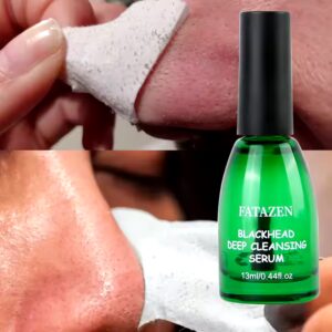 Deep Cleansing Blackhead Remover Patch For Nose Tea Tree Pore Cleanser Natural Plant Pore Treatment Serum - Image 3