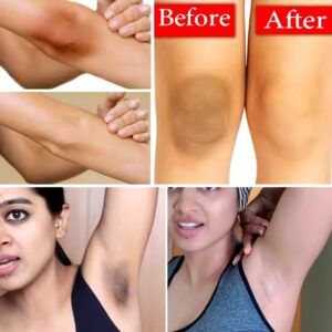 Arbutin Moisturizer Improves retextures of skin Exfoliating Cream Skincare Moisturizing Body Care Lotion - Image 5