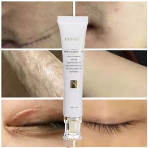 Women Face Body Care Scar Repair Cream Acne Treatment Firming Fast Effective Scar Removal Cream - Image 5
