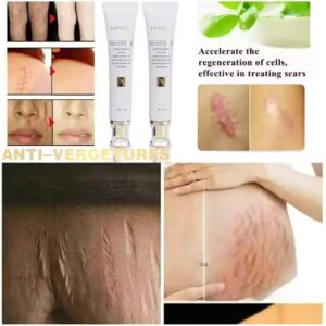 Women Face Body Care Scar Repair Cream Acne Treatment Firming Fast Effective Scar Removal Cream - Image 7