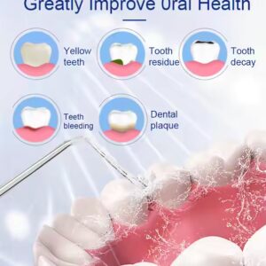 Dental USB Oral Irrigator Water Floss Pick Waterfloss Teeth Dental Water Flosser Teeth Cleaning - Image 7