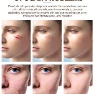 Women Face Body Care Scar Repair Cream Acne Treatment Firming Fast Effective Scar Removal Cream - Image 6