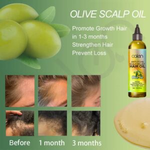 Olive Oil Hair Scalp Oil Organic Natural For Hair Growth Anti-Itching Dandruff Relief Scalp Oil - Image 4