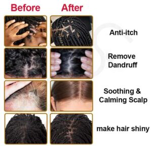Olive Oil Hair Scalp Oil Organic Natural Scalp Massage Oil For Hair Growth Anti-Itching 4OZ - Image 7