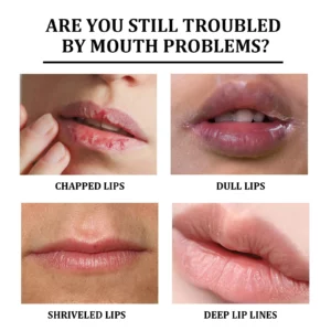 Remove Dark Lip Balm Lighten Melanin Lip Mask Exfoliating Fade Lip Line Dead Skin Moisturizing Brighten Repair Lip Care Products - Image 4