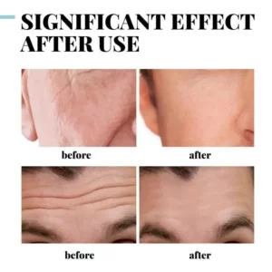 Collagen Anti Wrinkle Cream For Men Hyaluronic Remove Wrinkles Firming Lifting Moisturizing Anti Aging Brightening Face Care New - Image 3