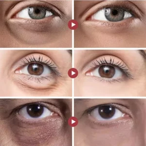 Retinol Anti Wrinkle Eye Serum Capsules Firming Lifting Remove Dark Circles Eye Bags Puffiness Moisturizing Whitening Eye Care - Image 2